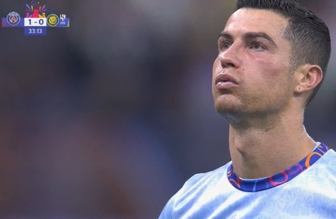 Hành động đáng yêu của Mbappe khi C.Ronaldo bị sưng mặt - Ảnh 2.