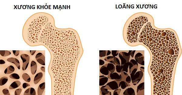 8 loại thực phẩm giàu canxi giúp xương chắc khỏe - Ảnh 2.