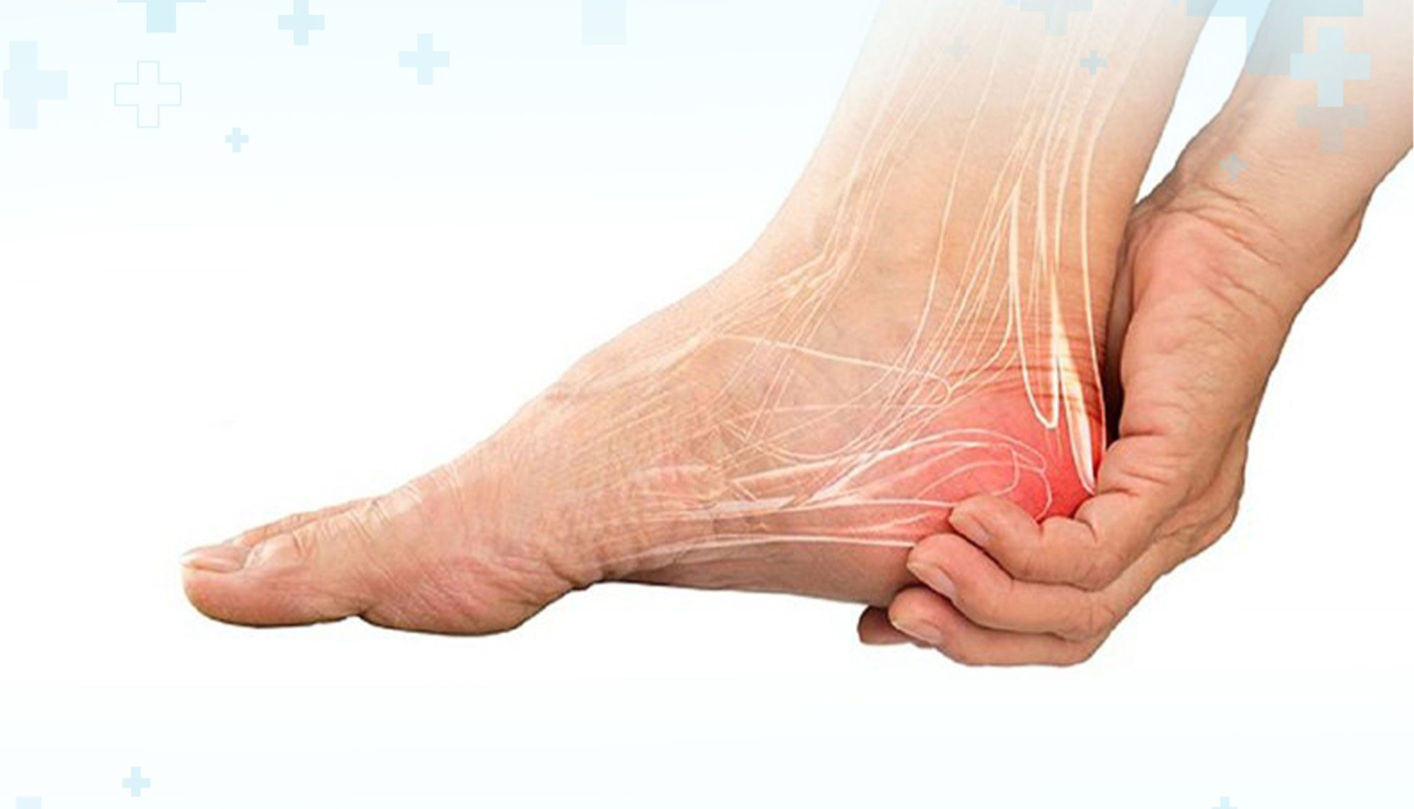 Điểm danh 6 nguyên nhân khiến gót chân đau nhói khi di chuyển - Ảnh 1.