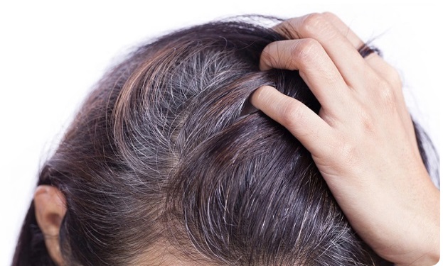 Còn trẻ mà bị tóc bạc sớm cùng với dấu hiệu này thì cần khám ngay còn kịp, đây là cách tốt nhất để ngăn chặn tóc bạc sớm! - Ảnh 3.