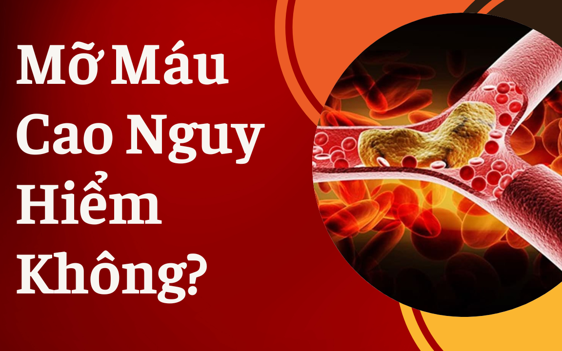 Mỡ máu cao tàn phá cơ thể như thế nào? Đây là 3 nhóm người có nguy cơ cao mắc bệnh mỡ máu!