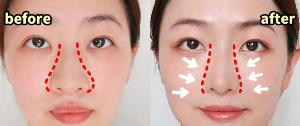 Động tác massage 3 phút mỗi ngày giúp chị em cải thiện nhược điểm mũi tẹt, mũi to- Ảnh 3. Động tác massage 3 phút mỗi ngày giúp chị em cải thiện nhược điểm mũi tẹt, mũi to- Ảnh 3.