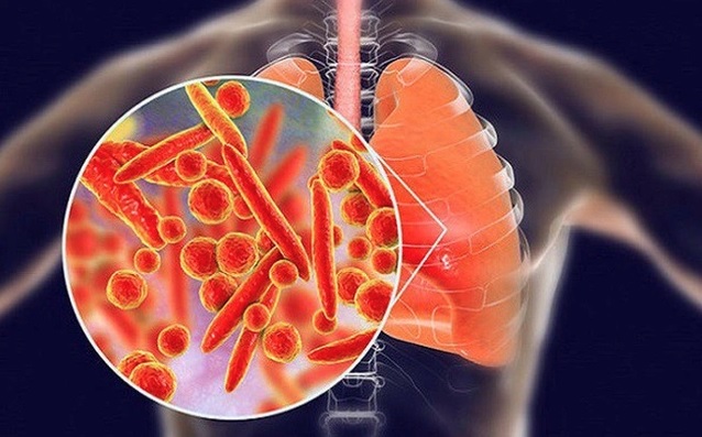 5 nhóm thực phẩm làm sạch phổi, tốt cho đường hô hấp, mùa đông nên ăn thường xuyên - Ảnh 2.