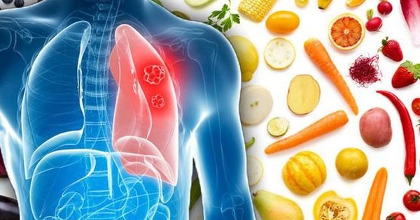 5 nhóm thực phẩm làm sạch phổi, tốt cho đường hô hấp, mùa đông nên ăn thường xuyên - Ảnh 3.