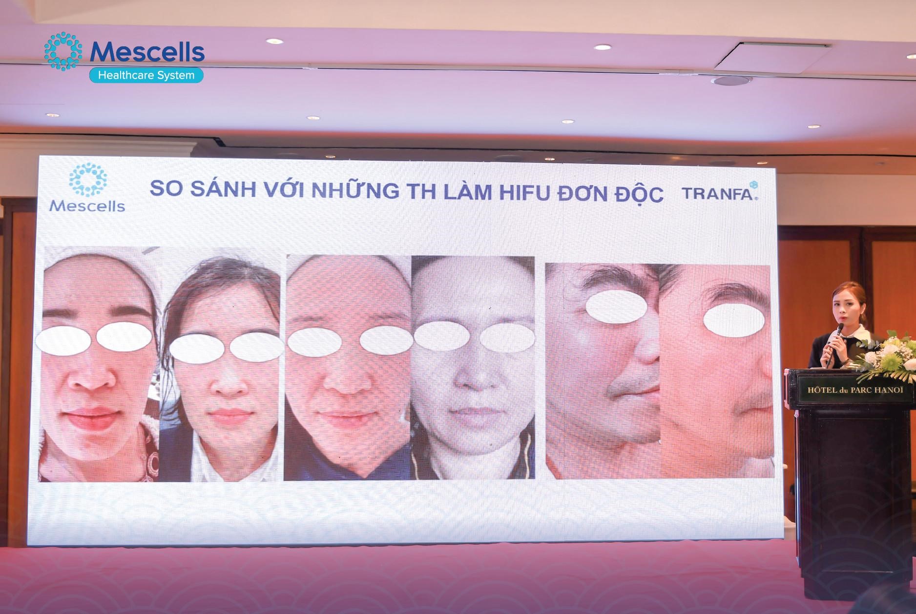 Workshop 2023 với chủ đề “Centerless Focused Ultrasound - Công nghệ sóng siêu âm hội tụ đến từ Châu Âu  - Ảnh 1.