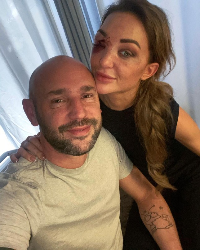 Gương mặt biến dạng của Hoa hậu Bỉ sau tai nạn xe hơi - Ảnh 1.