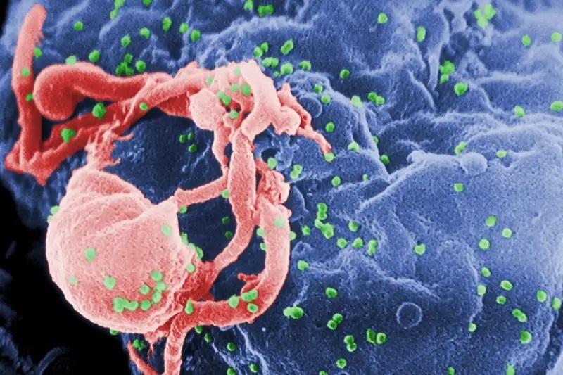 Người thứ ba được chữa khỏi HIV - Ảnh 1.