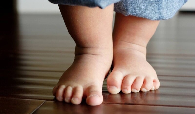 Một dấu hiệu ở bàn chân của con cảnh báo mắc phải dị tật mà 25% trẻ mắc phải - Ảnh 4.
