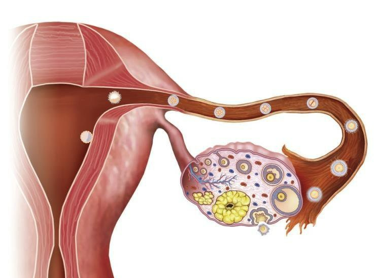 Biện pháp tránh thai nội tiết tố có thể gây vô sinh? - Ảnh 4. Biện pháp tránh thai nội tiết tố có thể gây vô sinh? - Ảnh 4.