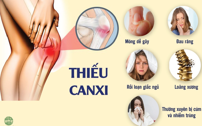 4 thực phẩm ăn nhiều sẽ 'bòn rút' canxi khủng khiếp, nếu có dấu hiệu này chứng tỏ cơ thể bạn thiếu canxi