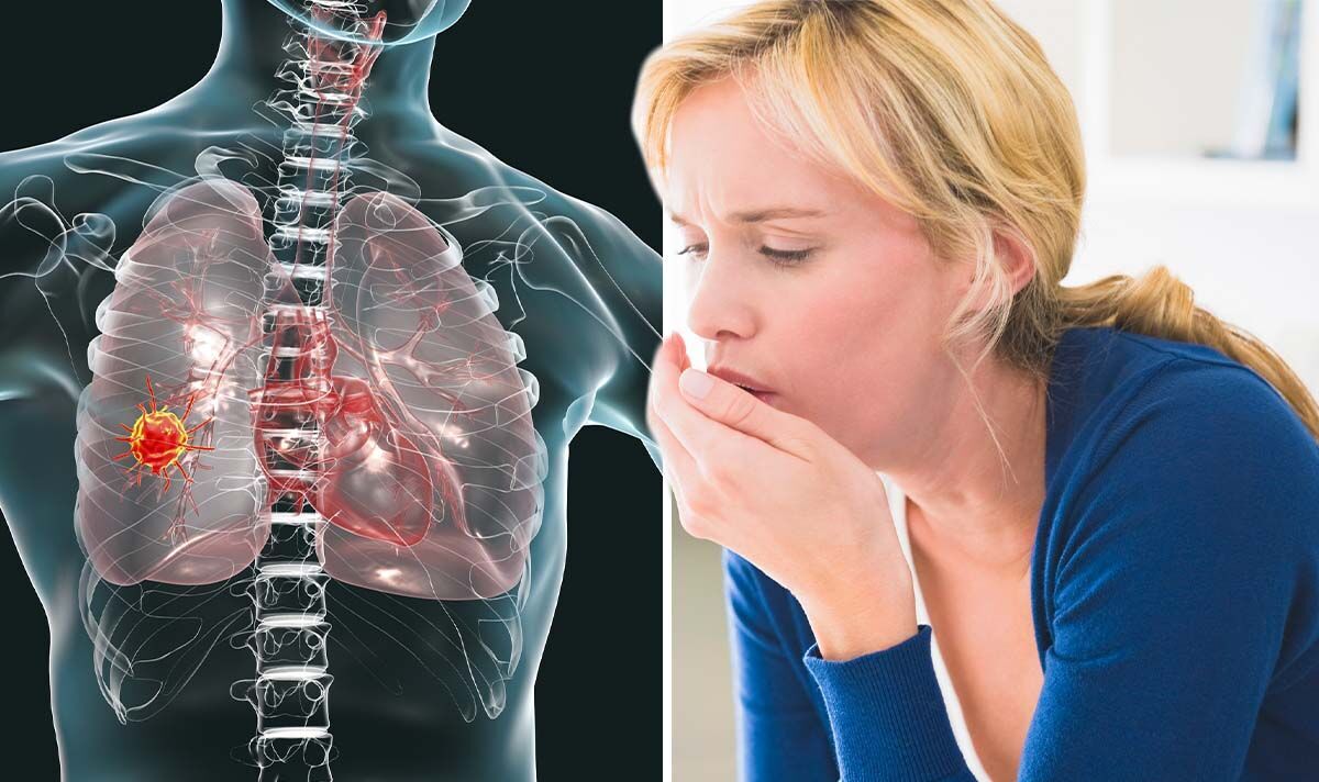 2 vị trí đau bất thường cảnh báo ung thư phổi nhưng dễ bị bỏ qua - Ảnh 1.