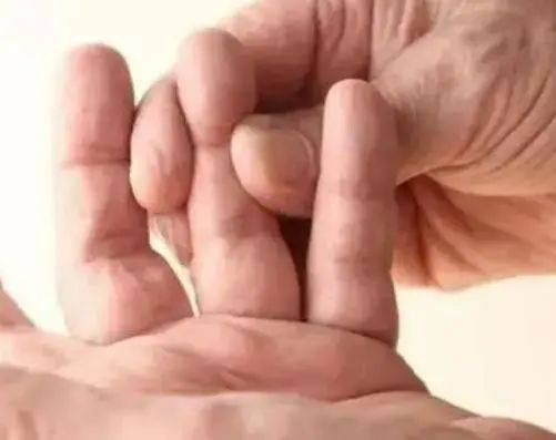 Người bị tăng huyết áp chú ý 4 bất thường ở bàn tay báo hiệu dễ bị nhồi máu não - Ảnh 8.