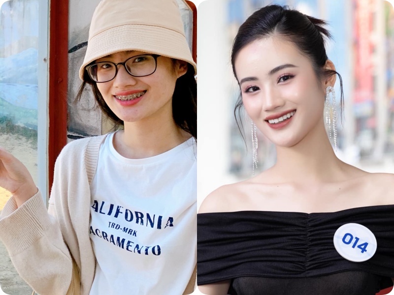 Trước khi đăng quang, tân Miss World Việt Nam Huỳnh Nhi từng có nhược điểm nhan sắc  - Ảnh 7.