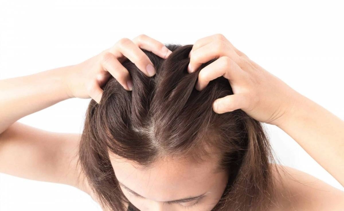 Hành tây giúp giảm rụng tóc hiệu quả - Ảnh 3.