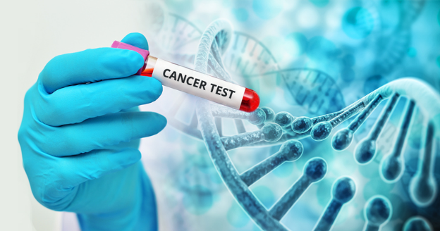 Có nên xét nghiệm gen để biết mình bị ung thư hay không? - Ảnh 1.
