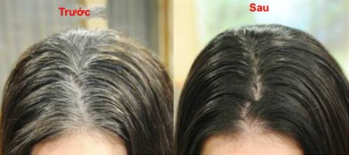 Tác hại của thuốc nhuộm tóc đối với sức khỏe - Ảnh 4.