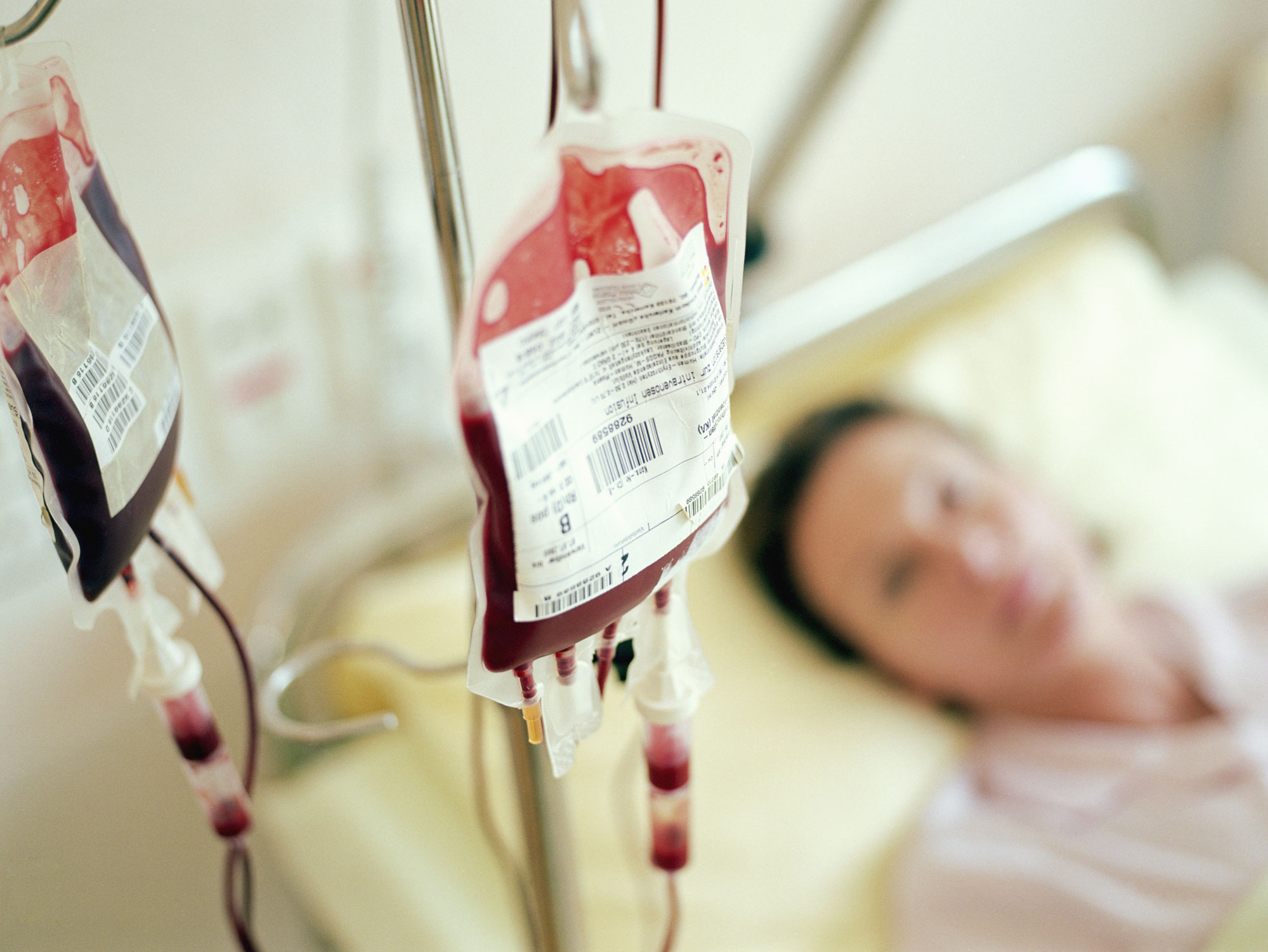 Thiếu máu: Nguyên nhân, dấu hiệu và cách điều trị - Ảnh 2.