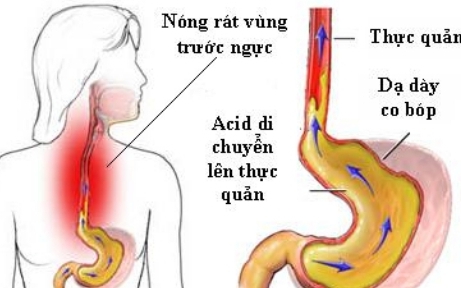 Bị ho dai dẳng suốt 20 năm không khỏi, đi khám mới biết nguyên nhân vì một thói quen xấu này