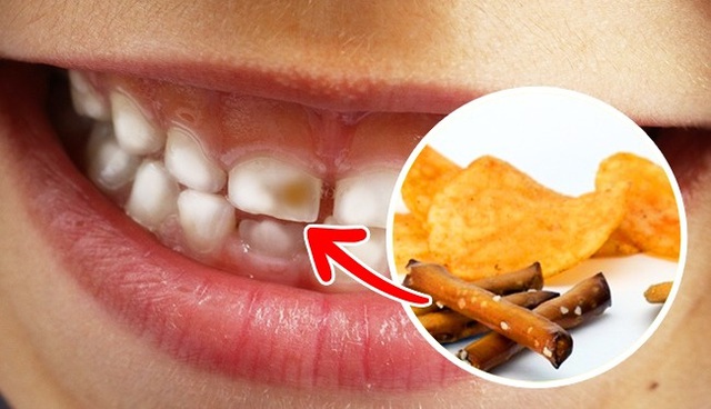 5 nhóm thực phẩm bạn nên ăn để răng chắc khỏe- Ảnh 1.