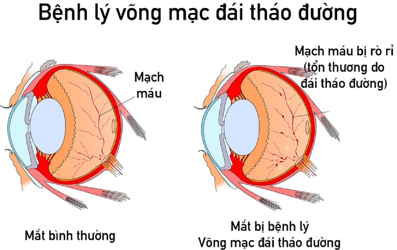 Cách kiểm soát đường huyết trong mùa đông- Ảnh 2.