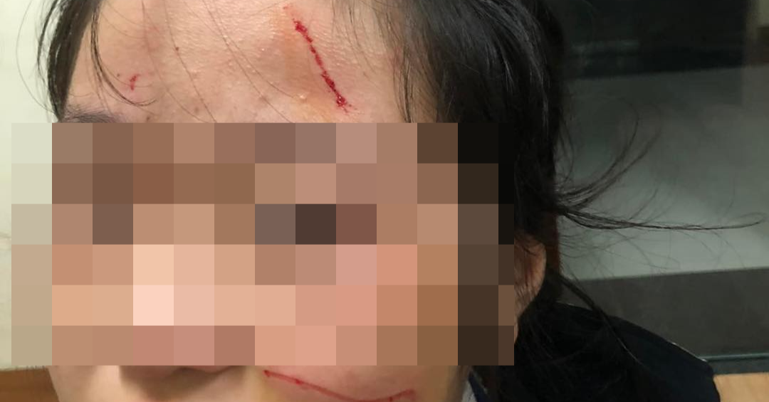 Thực hư thông tin nữ sinh Hà Nội bị rạch mặt tại trường học