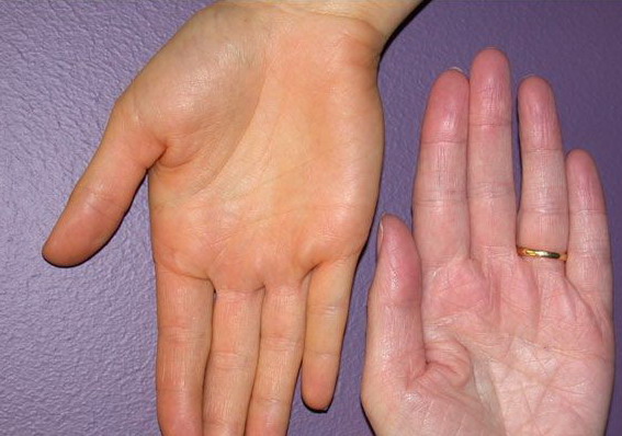 Bàn tay có thể nói lên tuổi thọ của một người, sống lâu ắt sẽ xuất hiện 6 điểm đặc biệt - Ảnh 1.