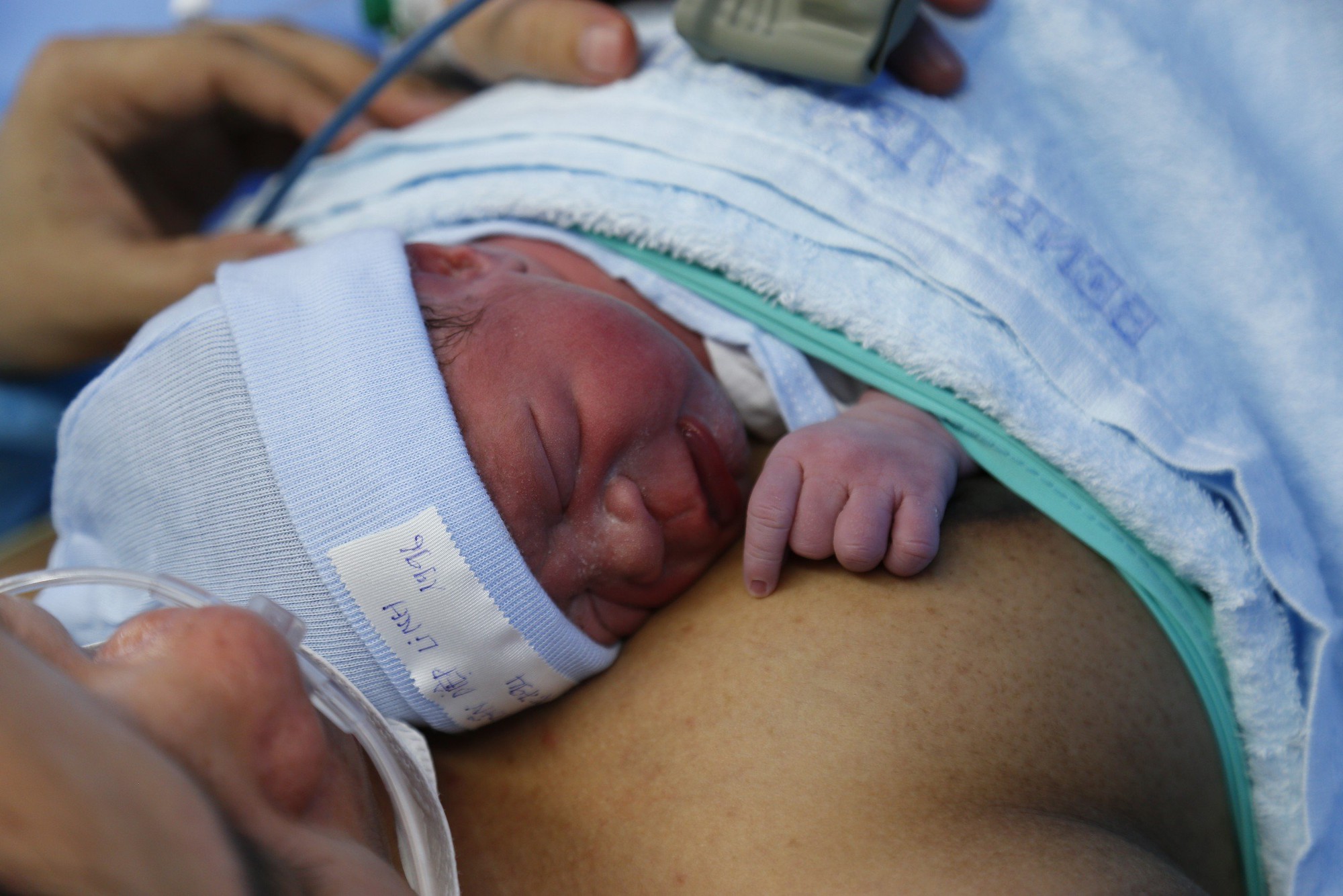 Em bé đầu tiên ở Việt Nam được thông van tim từ trong bào thai chào đời khỏe mạnh- Ảnh 3.