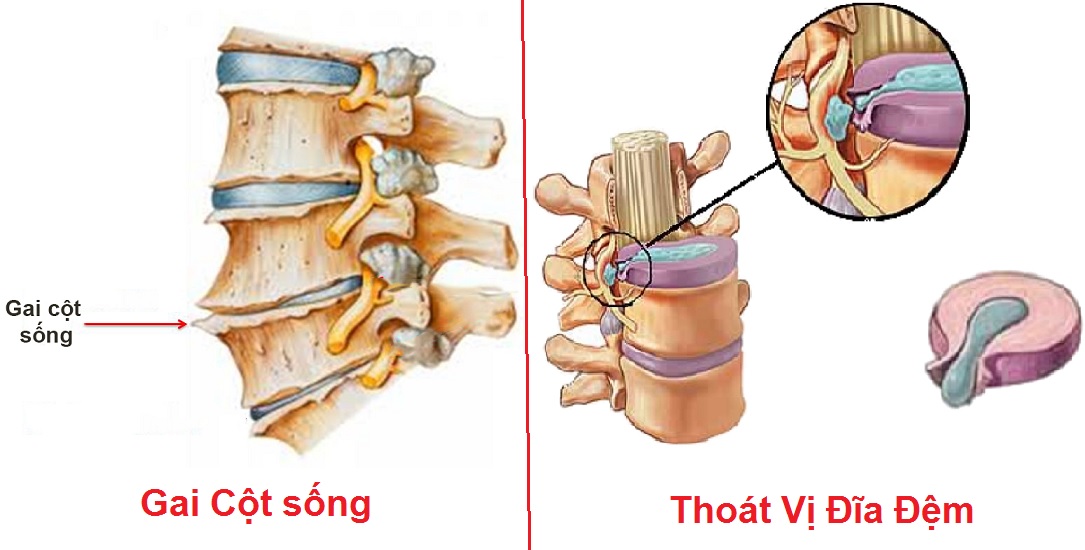 thoai-vi-dia-dem-2-17279398333211684709435-1728123701260-17281237018921998352660.jpg