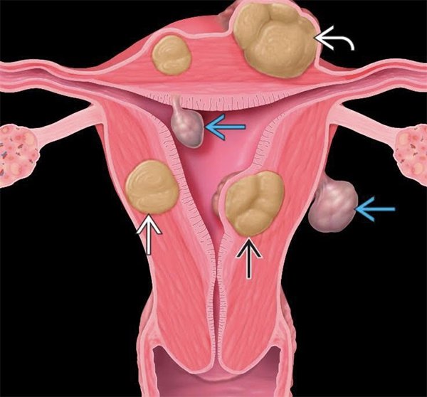 Chế Độ Chăm Sóc Sau Điều Trị