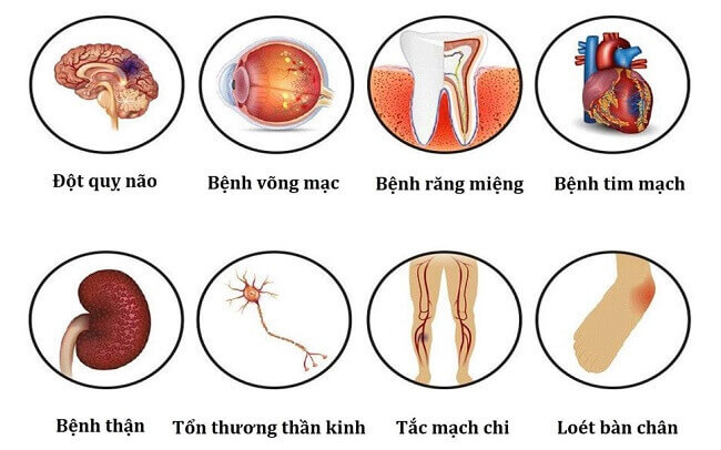 Mẹo hay giúp người tiểu đường hỗ trợ phòng và giảm nguy cơ biến chứng- Ảnh 1.