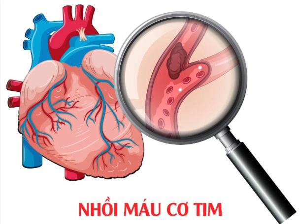 nhoi-mau-co-tim-cap-17338154721251233463734.jpg