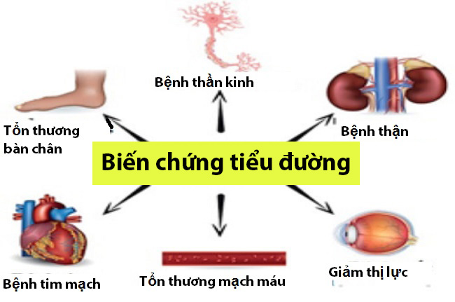 A man with diabetes has severe eye complications, doctors recommend that anyone with diabetes should do this to prevent complications - Photo 3. Người đàn ông mắc bệnh tiểu đường bị biến chứng nặng ở mắt, bác sĩ khuyến cáo ai mắc bệnh tiểu đường cần làm điều này để phòng biến chứng - Ảnh 3.
