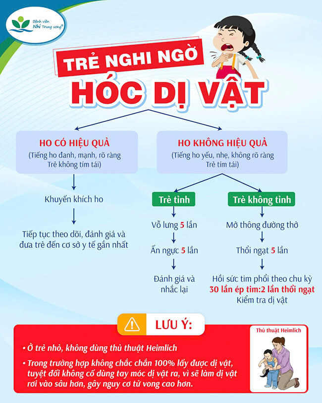 Bé trai 7 tuổi tử vong do hóc đầu bút: Cần làm gì để cứu con trong những tình huống nguy cấp?- Ảnh 3.