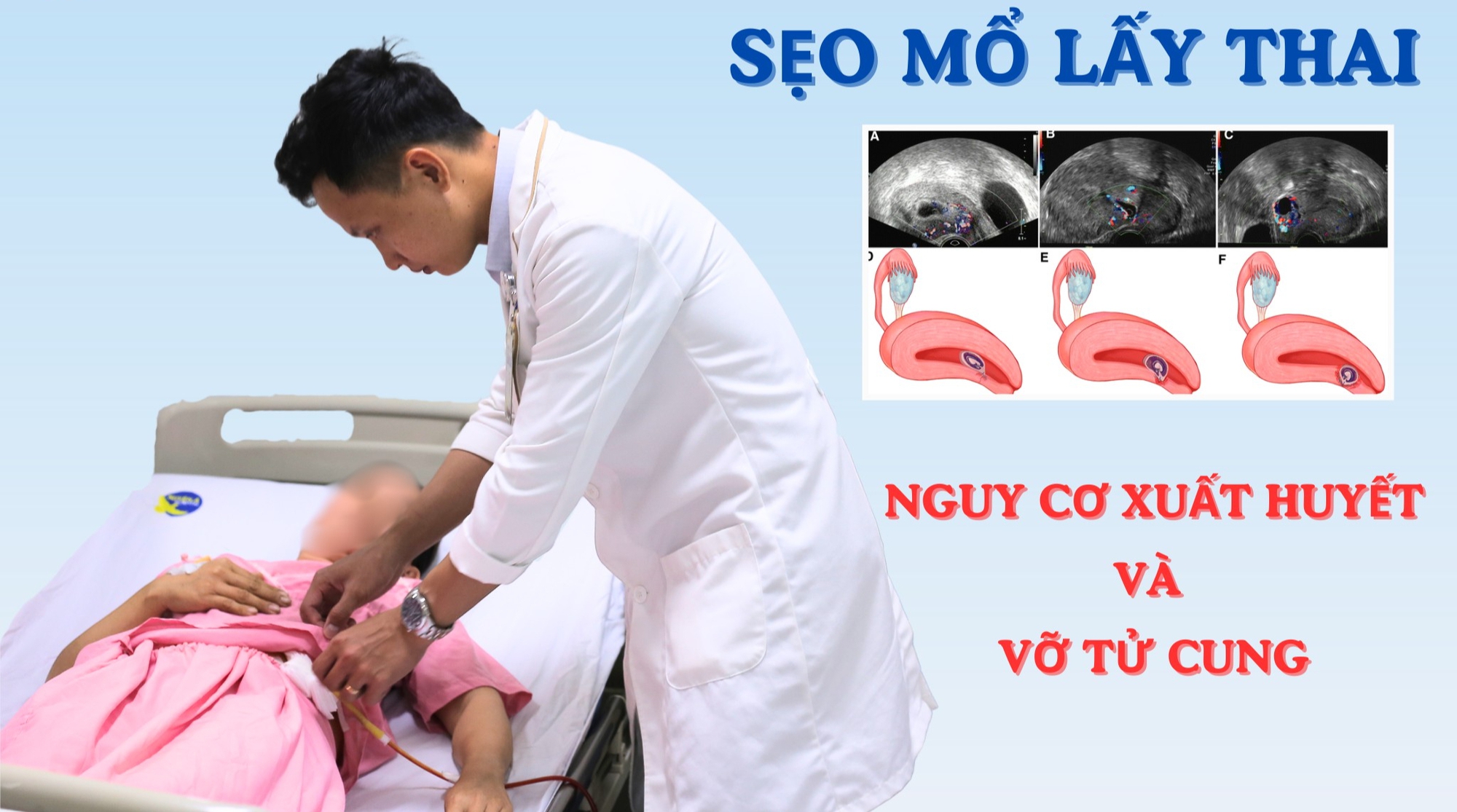 Sản phụ 40 tuổi ở Củ Chi nhập viện gấp vì thai bám ở sẹo mổ nguy hiểm - Ảnh 2.