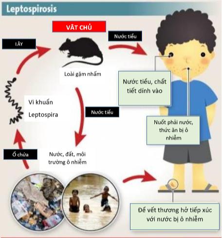 Sốt cao liên tục, 2 trẻ nhập viện trong tình trạng nặng vì nhiễm loại xoắn khuẩn nguy hiểm- Ảnh 2.