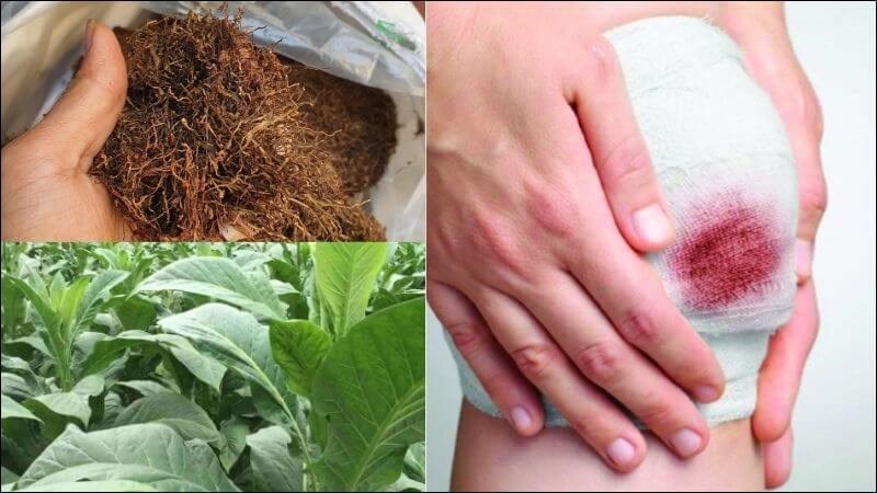 Người đàn ông 54 tuổi phải cắt cụt chân do sai lầm sau khi trật khớp gối- Ảnh 2.