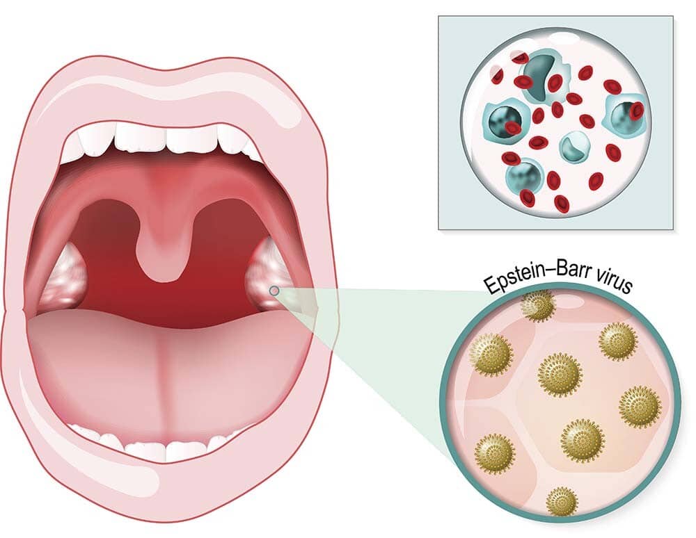 Một số bệnh do virus có thể lây truyền qua nụ hôn- Ảnh 1.
