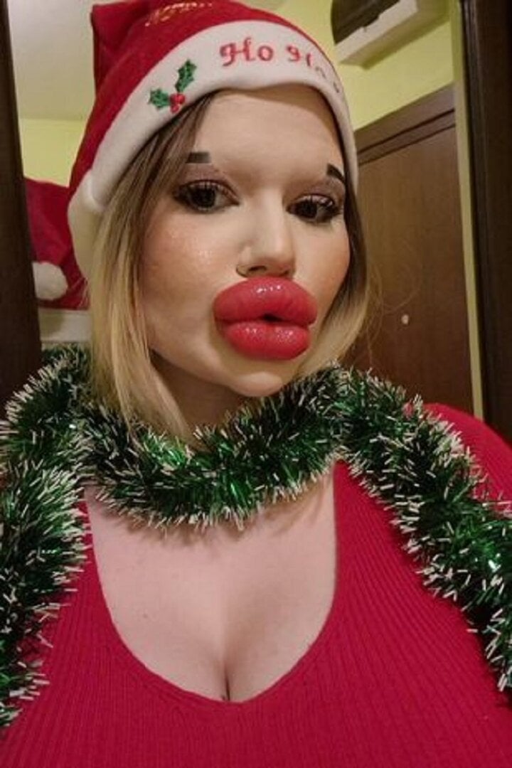 Cô gái có đôi môi lớn nhất thế giới muốn bán đấu giá những nụ hôn - Ảnh 2.