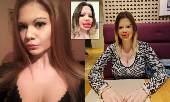 Cô gái có đôi môi lớn nhất thế giới muốn bán đấu giá những nụ hôn - Ảnh 4.