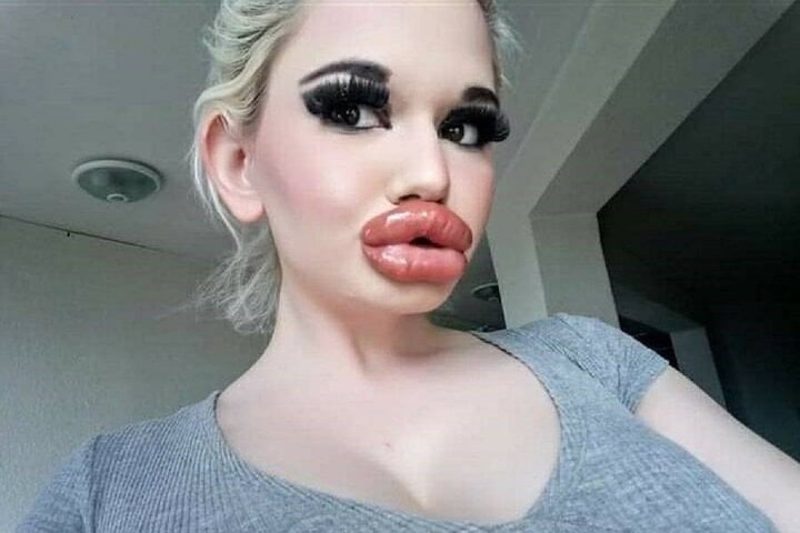 Cô gái có đôi môi lớn nhất thế giới muốn bán đấu giá những nụ hôn - Ảnh 1.