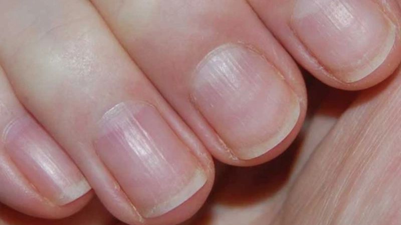 Móng tay, chân cùng với da, tóc thuộc lớp ngoài của cơ thể. Đôi khi sức khỏe của móng tay cũng là biểu hiện tình trạng sức khỏe bên trong của người.