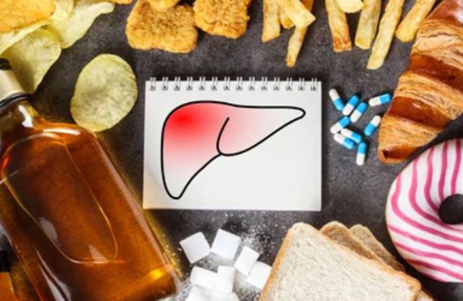 کبد داغ چقدر خطرناک است؟ برای خنک کردن کبد در روزهای گرم چه باید کرد - عکس ۳. Nóng gan nguy hiểm thế nào? Làm gì để 'giải nhiệt' cho gan trong ngày nắng nóng - Ảnh 3.