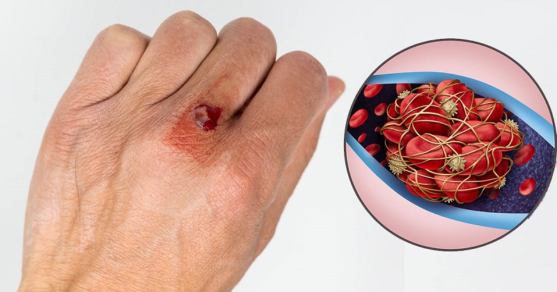 Surpreendentemente, 6 alimentos baratos que dissolvem coágulos sanguíneos que os vietnamitas devem comer para prevenir derrames - Foto 2. Bất ngờ 6 thực phẩm rẻ tiền làm tan cục máu đông, người Việt nên ăn để phòng đột quỵ- Ảnh 2.