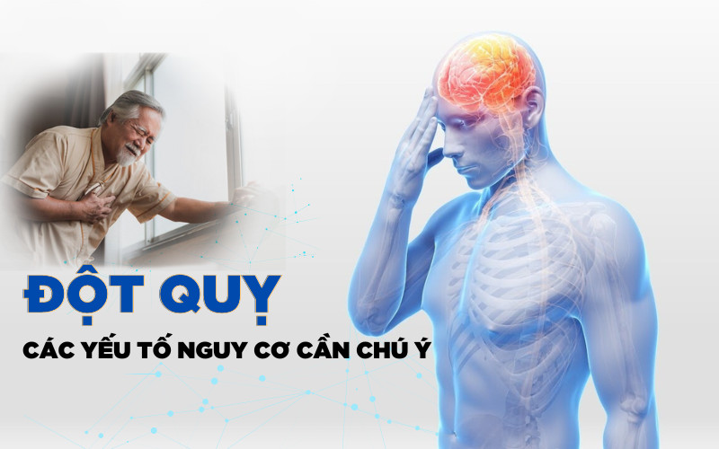 Đột quỵ do nắng nóng là tình trạng tăng thân nhiệt gây đáp ứng viêm hệ thống dẫn tới tổn thương nhiều cơ quan trong cơ thể, trong đó tổn thương thần kinh là nổi bật.