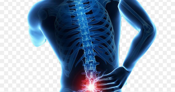 Thoát vị đĩa đệm: Nguyên nhân, biểu hiện, cách điều trị và phòng bệnh