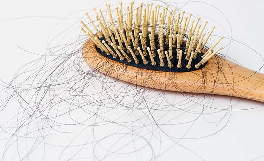 Bệnh tuyến giáp gây rụng tóc là triệu chứng phổ biến, ảnh hưởng đến tâm lý người bệnh, đặc biệt là nữ giới.