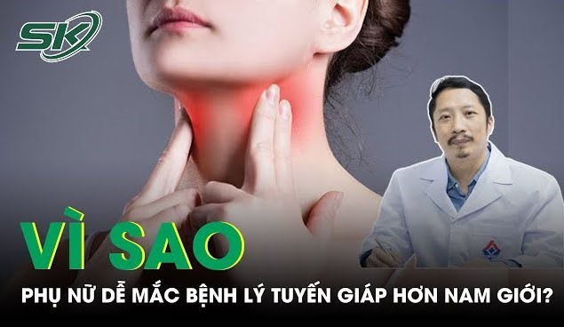 Bác sĩ Mai Văn Sâm làm khách mời của VTV, chia sẻ bí quyết 'dễ và rẻ' để giảm các bệnh về tuyến giáp- Ảnh 4.