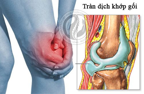 Ca sĩ Phương Linh tiết lộ lý do sức khỏe, căn bệnh cô mắc nguy hiểm thế nào?- Ảnh 3.