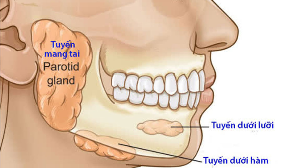 Người phụ nữ 57 tuổi suýt mất mạng vì khối u 14 năm không điều trị, bác sĩ chỉ rõ sai lầm khiến bệnh trở nặng- Ảnh 2.