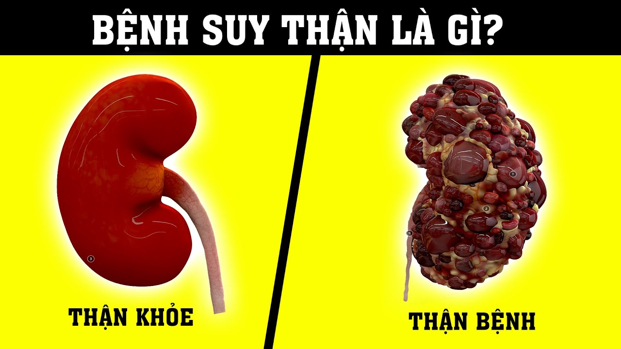 Suy Thận Không Đặc Hiệu Là Gì?